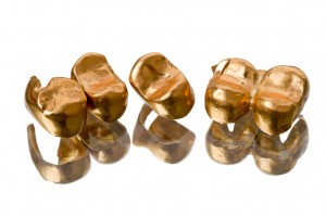 What’s Your Dental Gold Worth? What’s Your Dental Gold Worth?