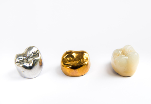 Here Are the Basic Facts to Understand if You Are Thinking of Selling Your Dental Gold